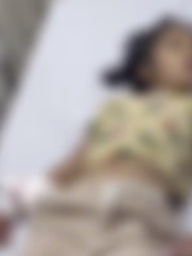 Sau 3 tháng bị chó cắn, bé gái 6 tuổi tử vong