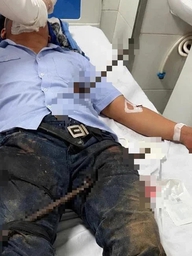 Thanh sắt đâm xuyên người, vì sao không được tự ý rút ra?