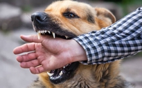 Phú Yên: Chó dại cắn khiến một người tử vong