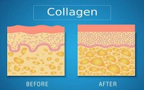 5 cách duy trì hàm lượng collagen ổn định cho làn da luôn căng mịn, tươi trẻ