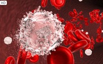 Ngày mới với tin tức sức khỏe: Dấu hiệu trên da cảnh báo ung thư máu