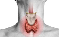 Tiêu chảy kéo dài có thể là dấu hiệu cảnh báo ung thư tuyến giáp