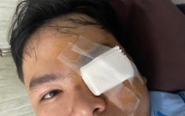 Nam thanh niên tố bị CSGT dùng gậy 'tác động vật lý' vào mắt phải nhập viện: PC08 xác minh