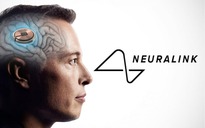 Tỉ phú Elon Musk: Ca cấy ghép chip não đầu tiên của Neuralink đã thành công