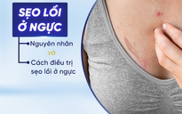 Sẹo lồi ở ngực: Nguyên nhân và cách điều trị ngay tại nhà không xâm lấn