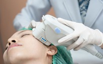 Chăm sóc bản thân trước và sau Ultherapy để da mặt được săn chắc lâu dài