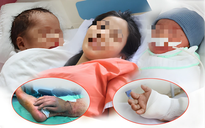 Sản phụ song thai được nối bàn tay đứt lìa ở TP.HCM: 'Tôi bật khóc'