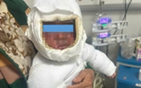 Kéo dây điện ấm đun nước siêu tốc, bé trai bị bỏng nặng