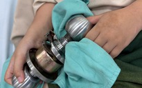 Bác sĩ 'hóa thợ khóa' cứu bé trai 5 tuổi kẹt ngón tay vào ổ khóa