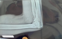 Ổ sán não bị chẩn đoán nhầm là u não