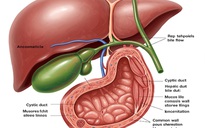 Thực phẩm bạn nên ăn hằng tuần để có túi mật khỏe mạnh