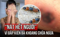 Đắp kiến ba khoang chữa ngứa, nam thanh niên tổn thương da toàn thân