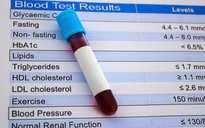 Phát hiện món ăn vặt giúp hạ cholesterol, cực tốt cho tim