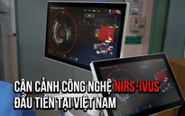 Cận cảnh công nghệ phát hiện xơ vữa, đánh giá nguy cơ nhồi máu cơ tim đầu tiên tại VN