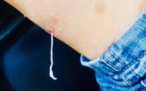 Việt Nam nghiên cứu về loài giun rồng mới ghi nhận