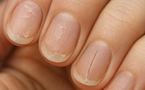 Ngày mới với tin tức sức khỏe: 4 dấu hiệu cảnh báo bạn không thực sự khỏe mạnh