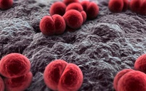Số ca nhiễm não mô cầu tăng: Bệnh lây lan qua những con đường nào?