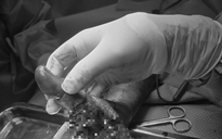 Thợ sửa ô tô bị dập nát bàn tay do nổ bình chữa cháy mini