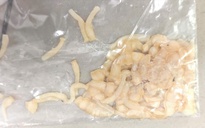 Nam thanh niên nhiễm sán dây dài 3 m