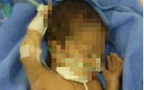 Kỳ tích cứu sống trẻ sinh non chỉ nặng 700 gram