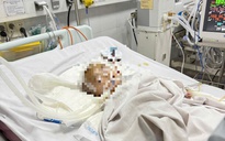 Công an điều tra vụ bé trai bị xuất huyết não ở nhóm trẻ tự phát