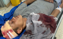 Nhóm côn đồ xông vào quán karaoke chém trọng thương chủ quán và nhiều người