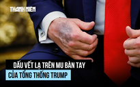 Vết bầm lạ trên mu bàn tay Tổng thống Trump là gì?