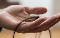 Rụng tóc từng mảng có mọc lại được không?