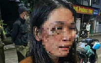 Công an xác minh vụ nữ shipper ở Đắk Lắk bị hành hung, phải nhập viện