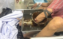 TP.HCM: Bị máy xay thịt 'nuốt chửng' tay, phải đưa cả người và máy vào phòng mổ