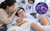 Tiếp xúc trẻ mắc não mô cầu đã vài ngày, uống kháng sinh dự phòng còn kịp?