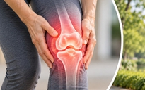 Chuyên gia chỉ cách đi bộ, tập luyện phù hợp cho người thoái hóa khớp gối