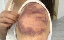 Tạm giữ hình sự đối tượng trói, đánh con ruột, hành hạ vợ mang thai