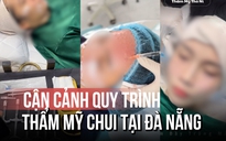 Thẩm mỹ 'chui' bủa vây: Cận cảnh quy trình làm đẹp không phép tại Đà Nẵng