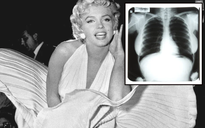 Ảnh X-quang của Marilyn Monroe gây phẫn nộ khi bị đấu giá