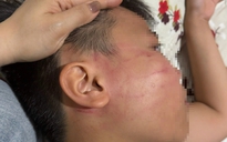Thầy giáo người Ấn Độ bị tố tát học sinh lớp 4