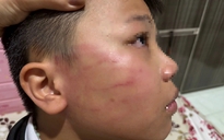 Thầy giáo người Ấn Độ tát học sinh lớp 4: Kiểm tra việc dạy thêm không phép