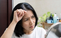 Nhổ tóc bạc có khiến tóc bạc nhiều hơn? Chuyên gia giải đáp