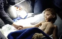 Bé trai sống sót sau 6 ngày mắc kẹt dưới đống đổ nát vì động đất Venezuela