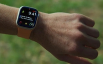 Vì sao Apple Watch bỗng xuất hiện viền xanh kỳ lạ?