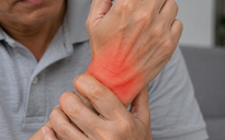 Bị gout vẫn có thể tập tạ, nhưng phải nhớ điều này
