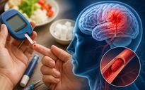 Bác sĩ giải thích vì sao tiểu đường có thể làm tăng nguy cơ đột quỵ