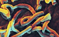 Đã nhiễm vi rút Ebola phải mang 'áo mưa' dài hạn