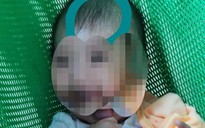 TP.HCM: Bé trai 6 tháng tuổi bị dập não khi gửi tại nhóm trẻ trong chung cư