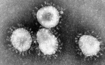 Trung Quốc điều tra dịch viêm phổi 'không thể lý giải', nghi là SARS