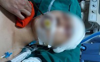 TP.HCM: Rơi từ lầu 3 của trường ở Phú Nhuận, nam sinh 13 tuổi chấn thương nặng