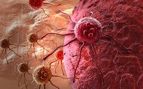Trị ung thư từ liệu pháp miễn dịch