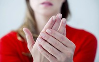 5 dấu hiệu gan đang bệnh thể hiện trên tay bạn