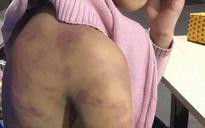 Hà Nội: Nghi án bé gái 12 tuổi bị mẹ ruột và người tình bạo hành, xâm hại