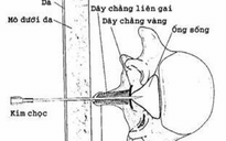 Khuyến cáo tai biến do gây tê tủy sống khi sinh mổ